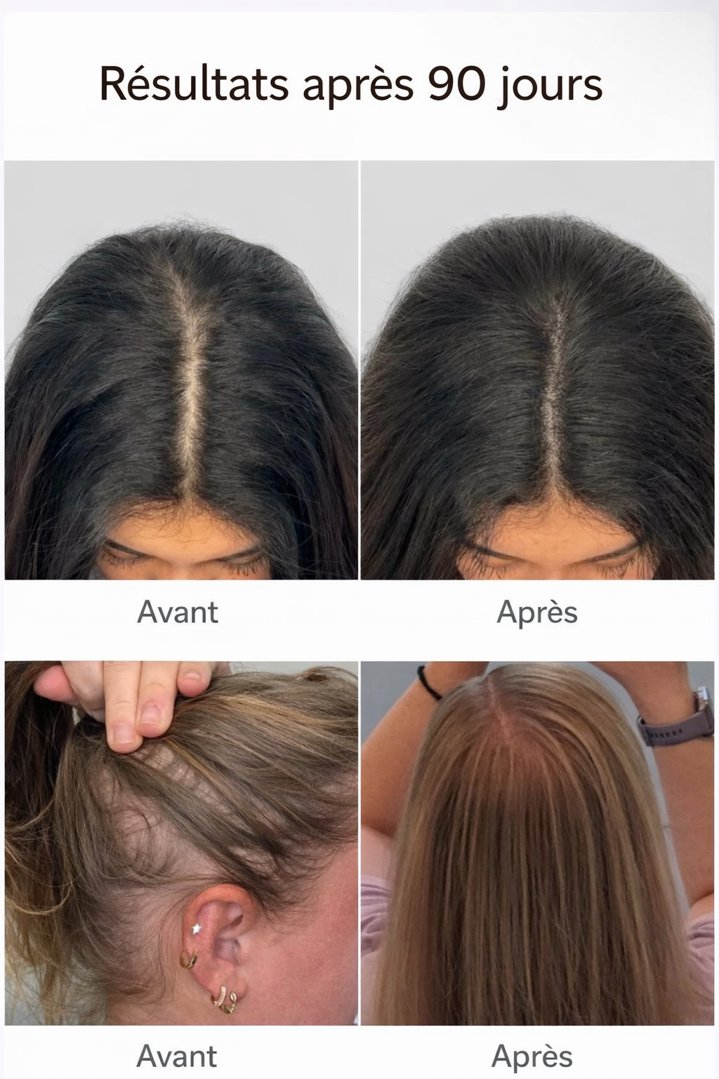 Lumihair - Traitement anti-chute - La technologie infrarouge au  service de vos racines